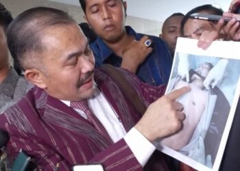 Hasil Autopsi Ulang Versi Keluarga, Brigadir J Diduga Ditembak dari Rahang, Otak Pindah Posisi ke Bagian Tubuh Lain