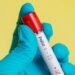 Waspada Suspect Polio di Kaltim, Fasilitas Kesehatan Dipantau 24 Jam