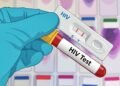 Ada 180 Kasus HIV Baru di Samarinda, Begini Fakta Sebenarnya
